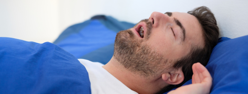 Sleep Apnea - Common Causes, Risk Factors, Treatments
